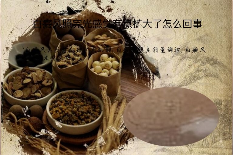 白癜风照完光感觉有点扩大了怎么回事”
