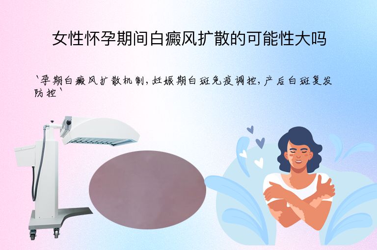 https://www.bdfsjzyy.com/d/file/p/5053d44a6e0375c85688b89f9475b6fe.jpeg