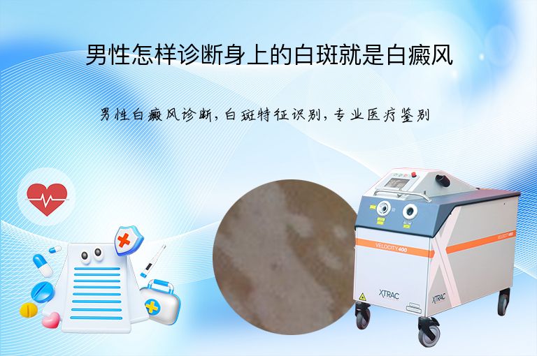 男性怎样诊断身上的白斑就是白癜风”