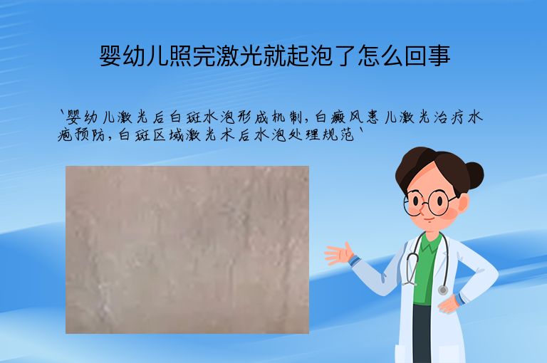 https://www.bdfsjzyy.com/d/file/p/5ff539e9db67d8e4dcbc97b56c867a9f.jpeg