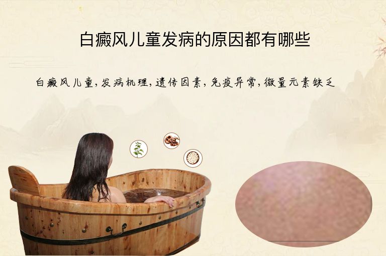 https://www.bdfsjzyy.com/d/file/p/e9742d708a8c3796926ddd3a2edd8b60.jpeg