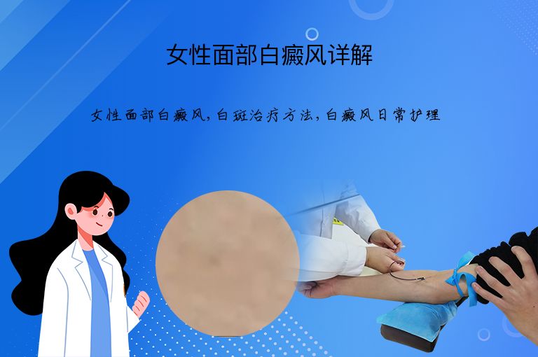 女性面部白癜风详解”