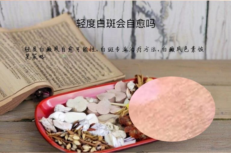 轻度白斑会自愈吗”
