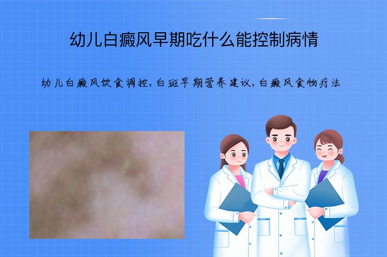 幼儿白癜风早期吃什么能控制病情”