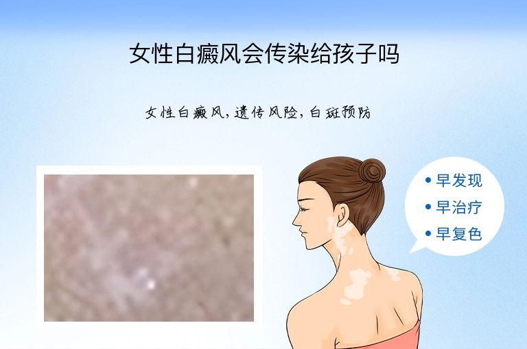 女性白癜风会传染给孩子吗”