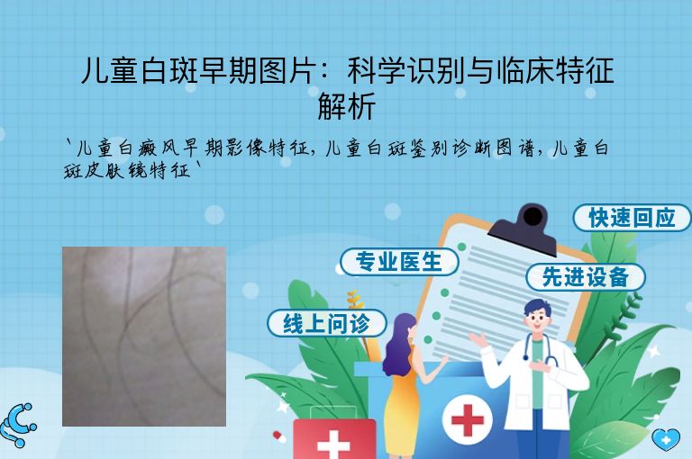 儿童白斑早期图片：科学识别与临床特征解析