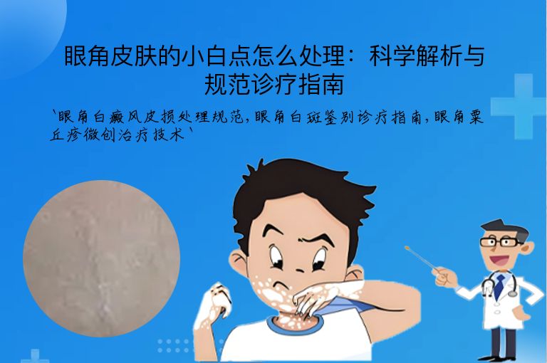 眼角皮肤的小白点怎么处理:科学解析与规范诊疗指南