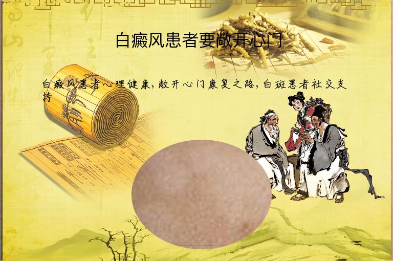 白癜风患者要敞开心门”