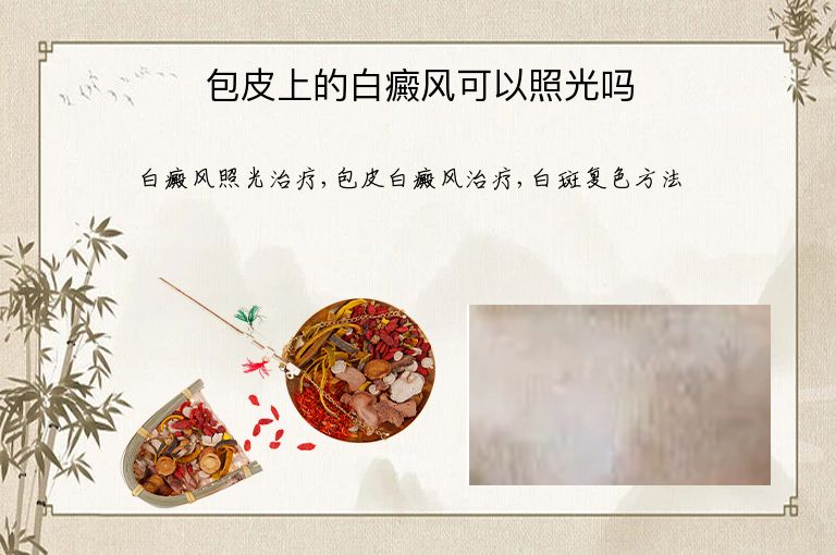 https://www.bdfsjzyy.com/d/file/p/5a90ee8e10e5e6da7d27d2a030e9829b.jpeg