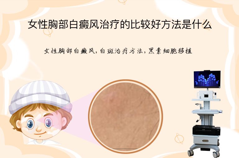 女性胸部白癜风治疗的比较好方法是什么”
