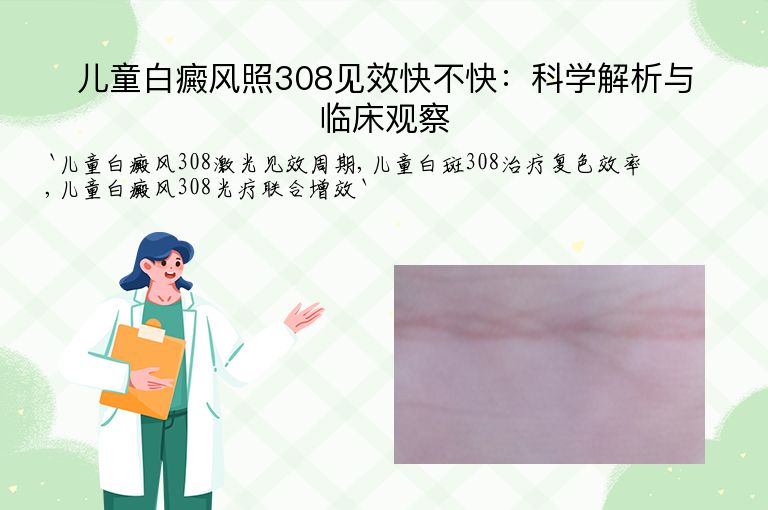 儿童白癜风照308见效快不快:科学解析与临床观察