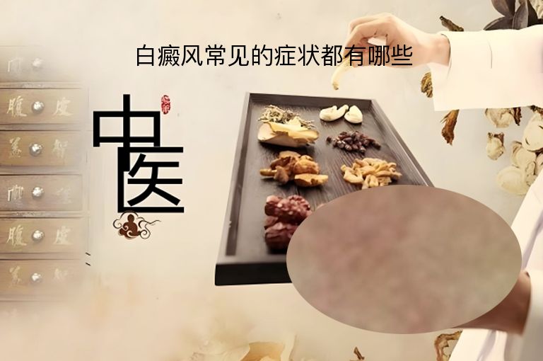 https://www.bdfsjzyy.com/d/file/p/b64fb634ae497ff5eb0bc39f06d813d0.jpeg