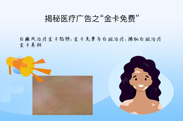 https://www.bdfsjzyy.com/d/file/p/51cc33206d9451a1a225849d17ae6655.jpeg