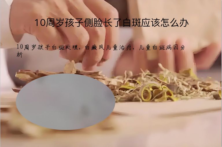 https://www.bdfsjzyy.com/d/file/p/fc0ee62eafa29a8474b2b65d1023cf03.jpeg