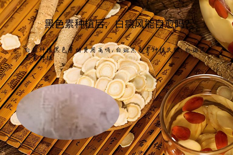 黑色素种植后，白癜风能自愈吗？”