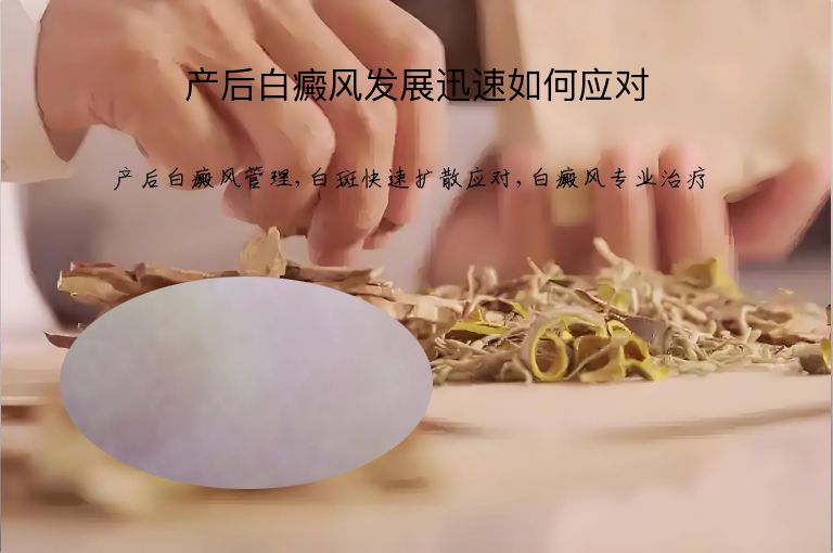 产后白癜风发展迅速如何应对”