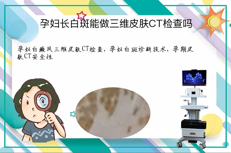 https://www.bdfsjzyy.com/d/file/p/b5cdaf96cbf81484e06e1380e6cf727b.jpeg