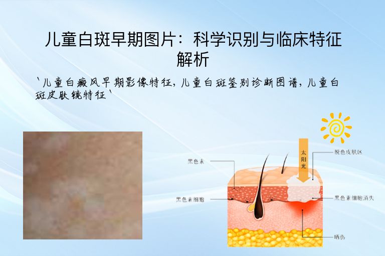 儿童白斑早期图片:科学识别与临床特征解析