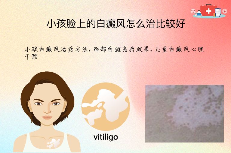 小孩脸上的白癜风怎么治比较好”