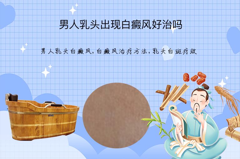 男人乳头出现白癜风好治吗”