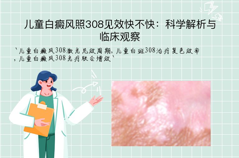 儿童白癜风照308见效快不快:科学解析与临床观察
