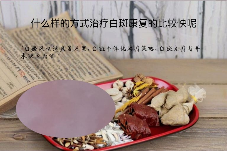 什么样的方式治疗白斑康复的比较快呢