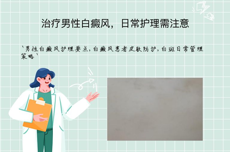 治疗男性白癜风,日常护理需注意