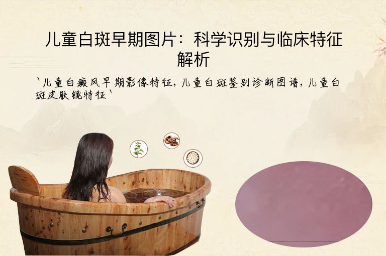 儿童白斑早期图片:科学识别与临床特征解析