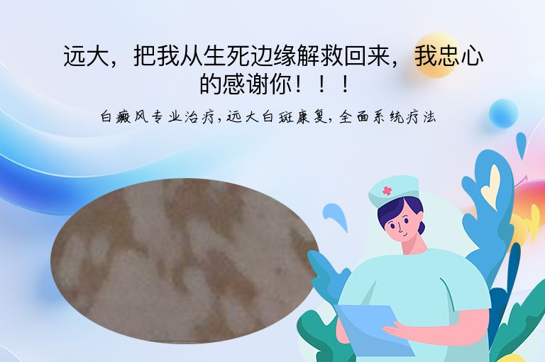 远大，把我从生死边缘解救回来，我忠心的感谢你！！！”