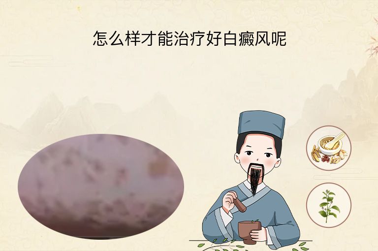 https://www.bdfsjzyy.com/d/file/p/8bf62cc867da911e4c839e4247c1250d.jpeg
