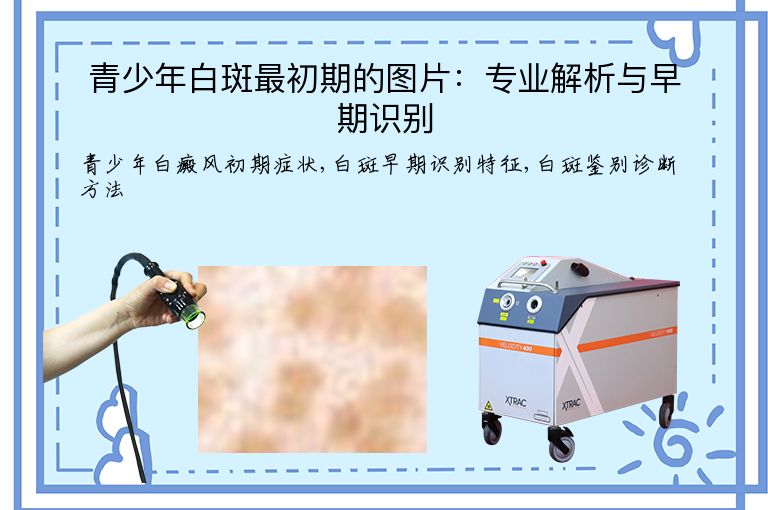 青少年白斑最初期的图片:专业解析与早期识别”