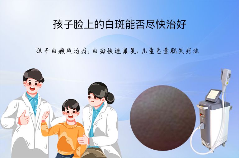 孩子脸上的白斑能否尽快治好”