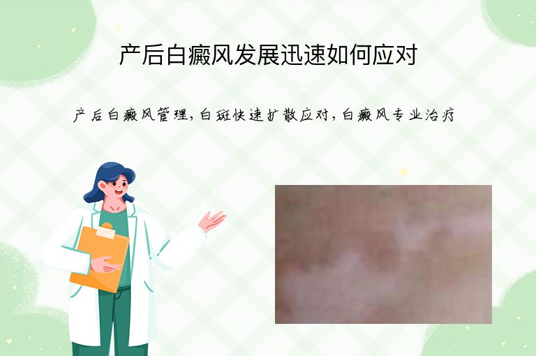 产后白癜风发展迅速如何应对”
