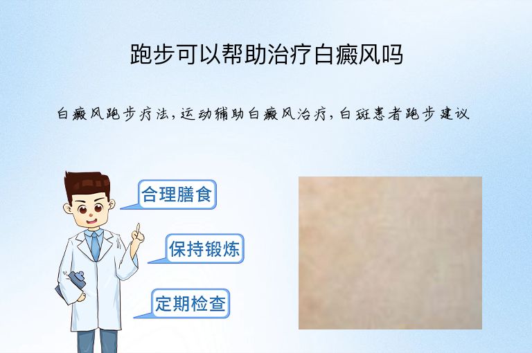 跑步可以帮助治疗白癜风吗”