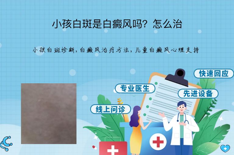 https://www.bdfsjzyy.com/d/file/p/45f75f8306539cbb5cb2e1c6fbba1563.jpeg