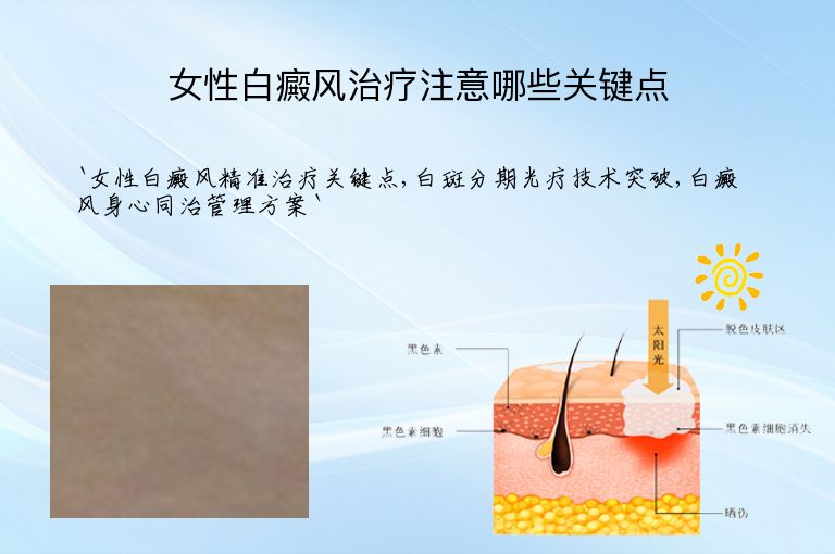 女性白癜风治疗注意哪些关键点”