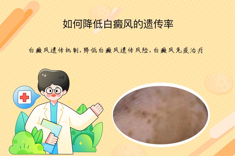 如何降低白癜风的遗传率”