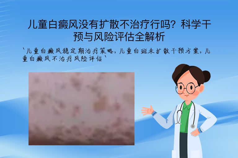 儿童白癜风没有扩散不治疗行吗？科学干预与风险评估全解析