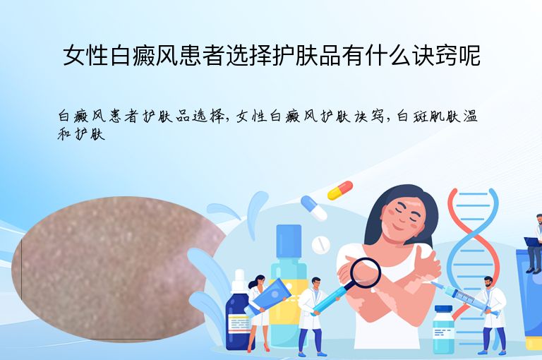 https://www.bdfsjzyy.com/d/file/p/0bf605f03fa50d4520cd4be89c6b04df.jpeg