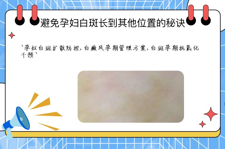 避免孕妇白斑长到其他位置的秘诀