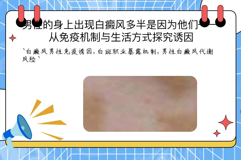 男性的身上出现白癜风多半是因为他们——从免疫机制与生活方式探究诱因