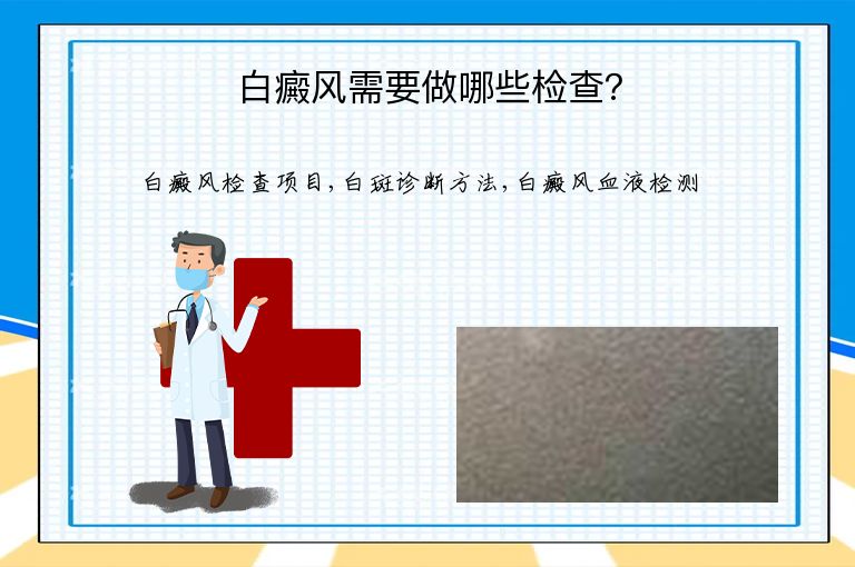 白癜风需要做哪些检查?”