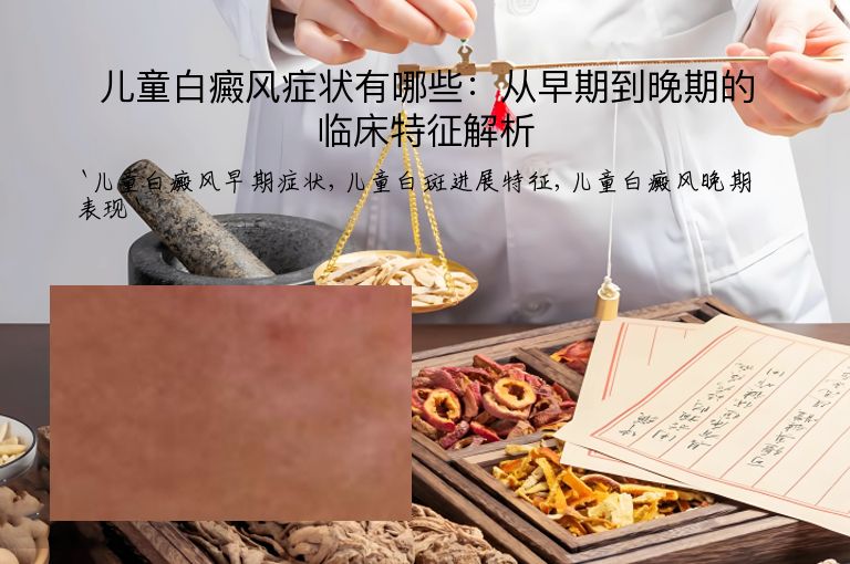 儿童白癜风症状有哪些：从早期到晚期的临床特征解析