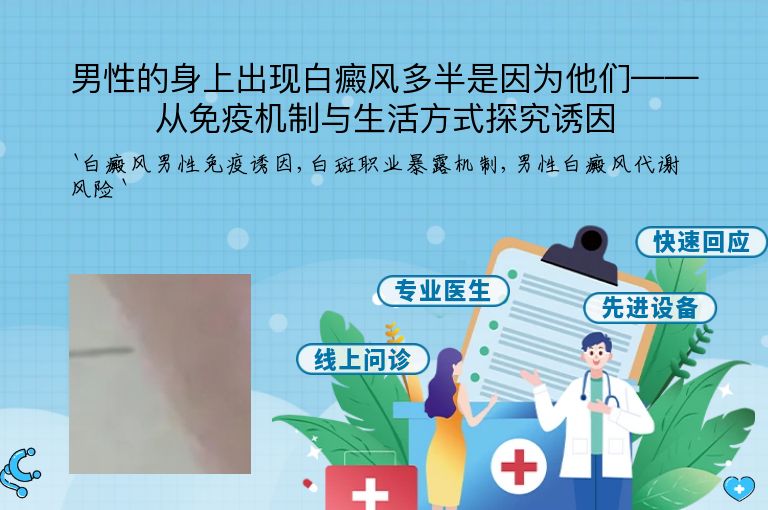 男性的身上出现白癜风多半是因为他们——从免疫机制与生活方式探究诱因