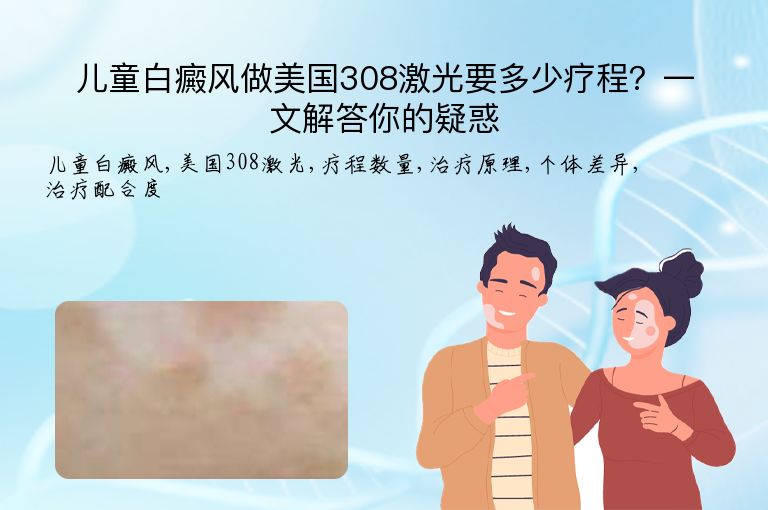 儿童白癜风做美国308激光要多少疗程？一文解答你的疑惑”