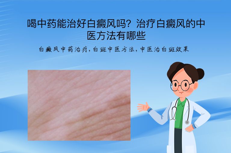 喝中药能治好白癜风吗?治疗白癜风的中医方法有哪些”