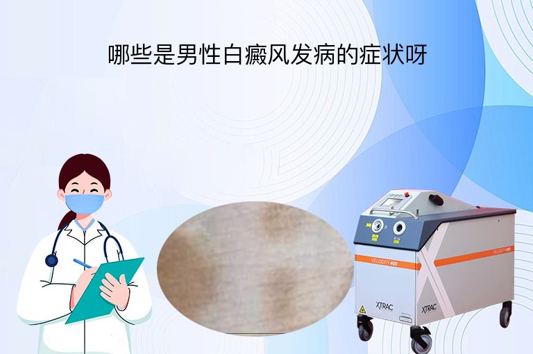哪些是男性白癜风发病的症状呀