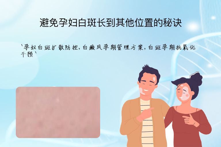 避免孕妇白斑长到其他位置的秘诀