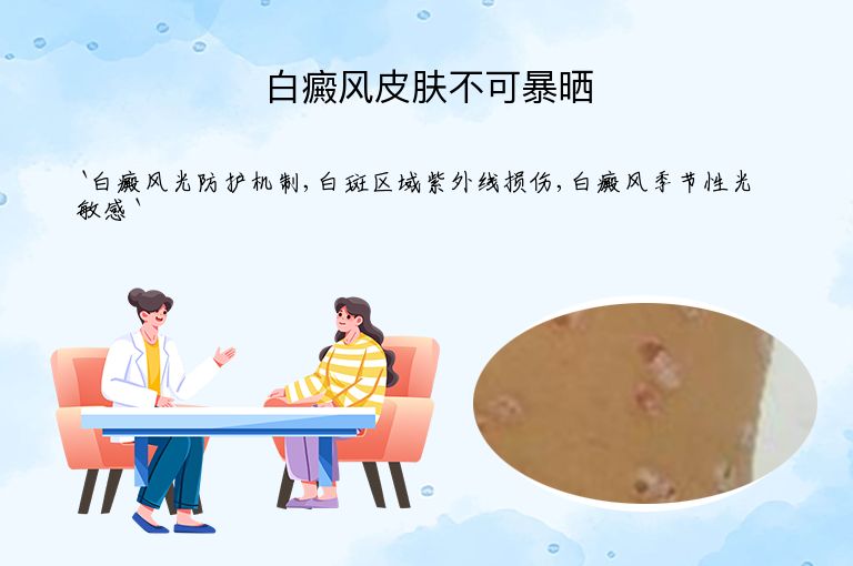 白癜风皮肤不可暴晒”