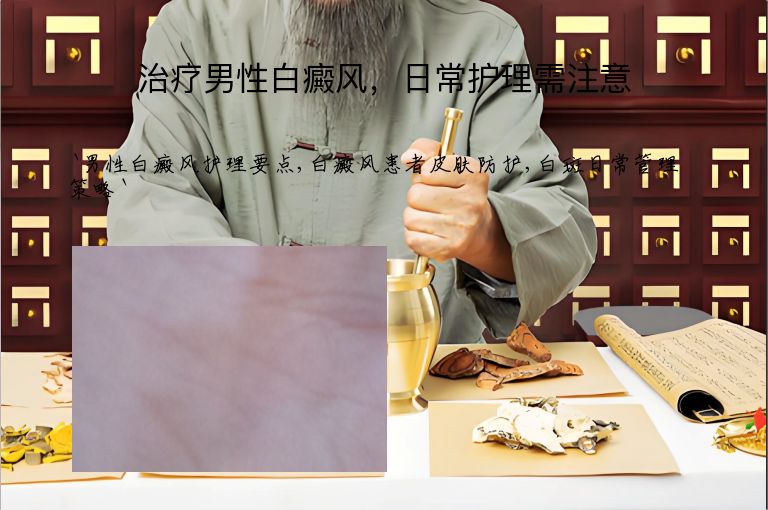 治疗男性白癜风,日常护理需注意